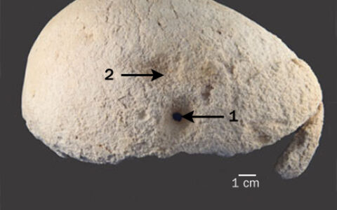 生物考古學家可能發現了北美最古老的頭骨手術案例